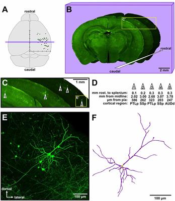 Cross-Regional Gradient of Dendritic Morphology in Isochronically-Sourced Mouse Supragranular Pyramidal Neurons